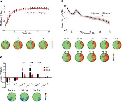Disrupted Spatiotemporal Complexity of Resting-State Electroencephalogram Dynamics Is Associated With Adaptive and Maladaptive Rumination in Major Depressive Disorder
